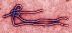 FILE - This undated file image made available by the Centers for Disease Control (CDC) shows the Ebo …
