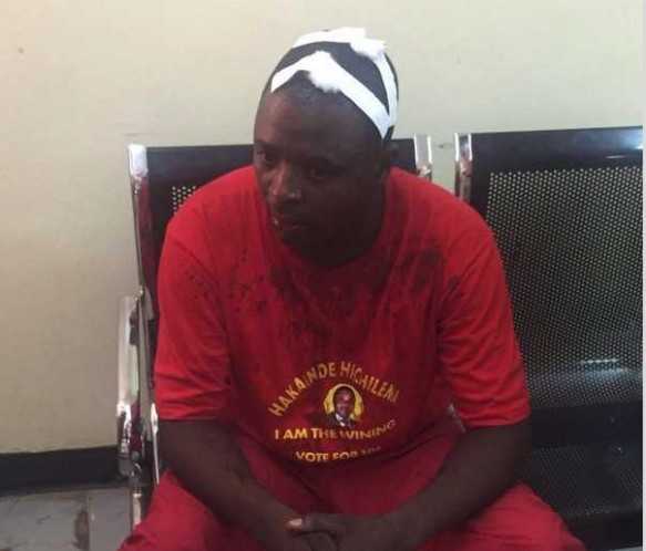 youths were unnecessarily attacked by PF thugs with the support of police which saw many injured